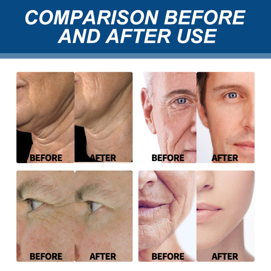 Men's facial skin tightening cream "East Moon"