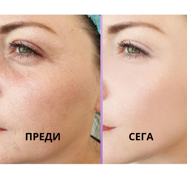 Eye Smoother Patches.